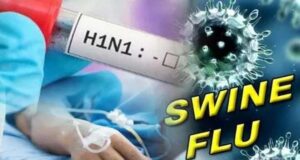 स्वाइन फ्लू को लेकर स्वास्थ्य विभाग अलर्ट, सभी CMHO को दिशा-निर्देश जारी…