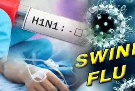 स्वाइन फ्लू को लेकर स्वास्थ्य विभाग अलर्ट, सभी CMHO को दिशा-निर्देश जारी…